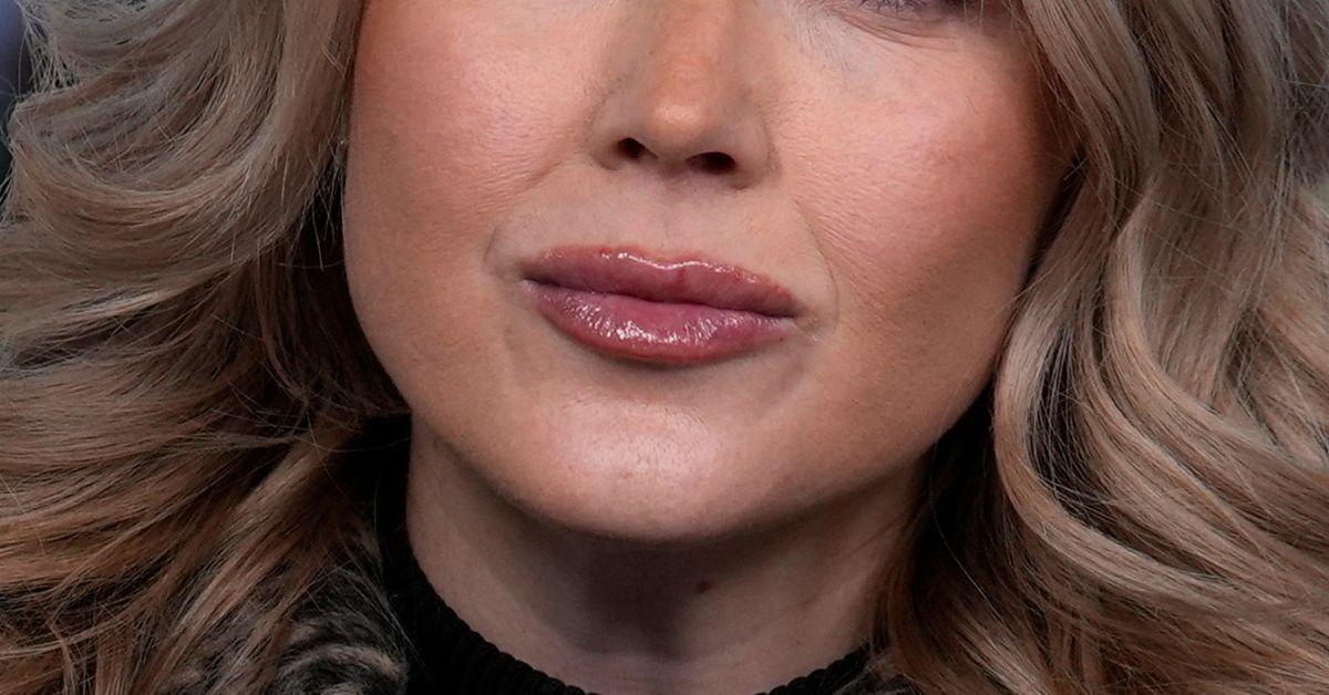 image of Critics focused on what they claimed were lip filler marks.